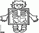 Child in X-rays to see the bones of the body