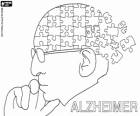 World Alzheimer Day, September 21. Alzheimer's disease is the most common neurodegenerative disease